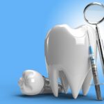 5 Must Know Things about PPC management for Dentists